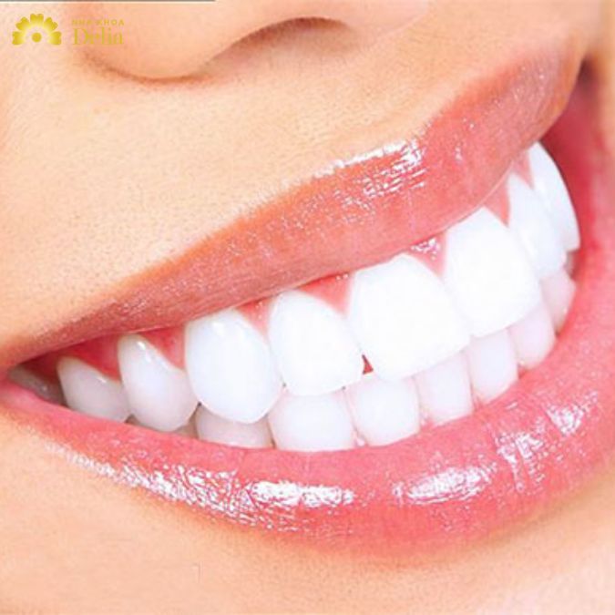 Thực chất tẩy trắng răng là gì?