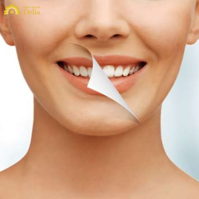 8 Lưu ý chăm sóc răng sau khi tẩy trắng giữ màu lâu nhất – Nha khoa Delia
