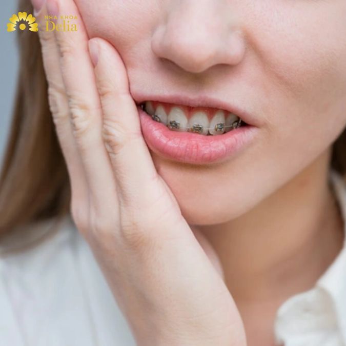 Về bản chất, niềng răng là phương pháp chỉnh nha an toàn để đưa răng về đúng vị trí