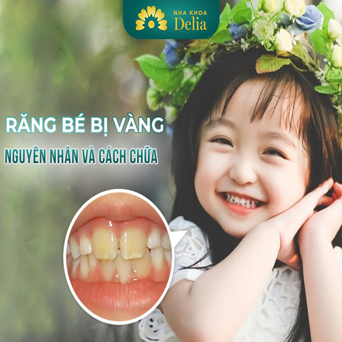 Răng trẻ bị ố vàng có thể do bẩm sinh hoặc các yếu tố thói quen ăn uống và chăm sóc răng miệng