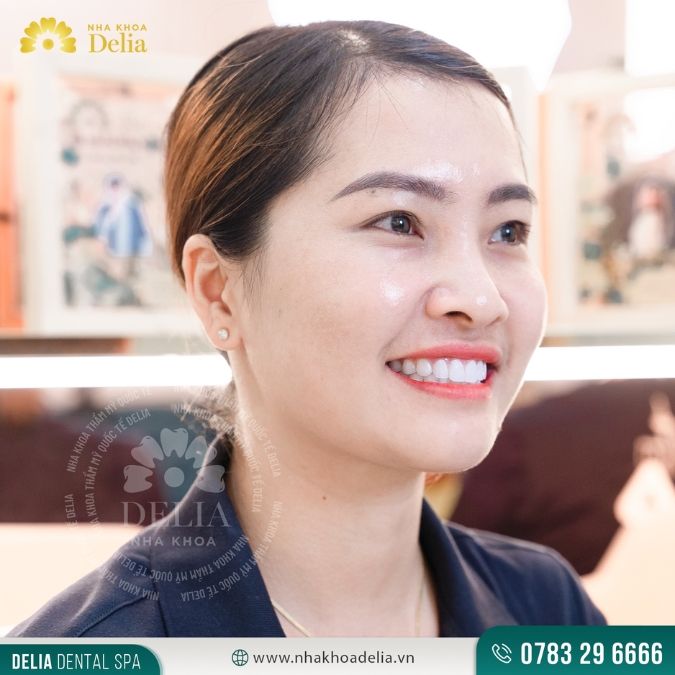 So sánh răng sứ Zirconia và Cercon