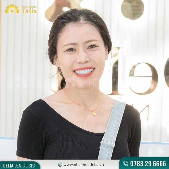 So sánh răng sứ Zirconia và Cercon