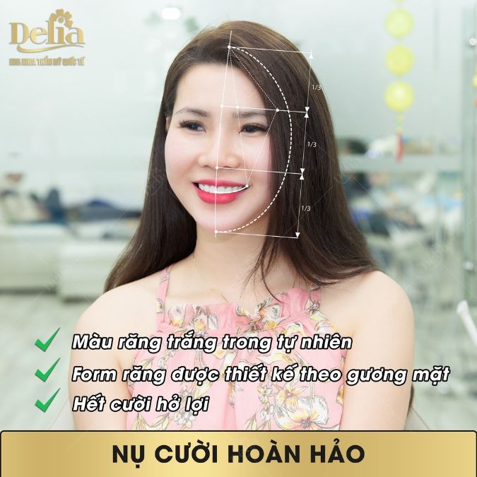 So sánh răng sứ Katana và Venus