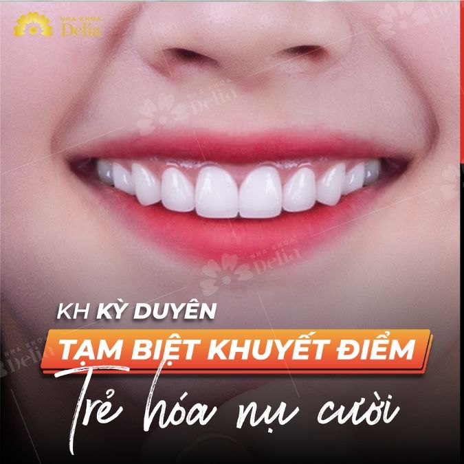 So sánh răng sứ Emax và Cercon