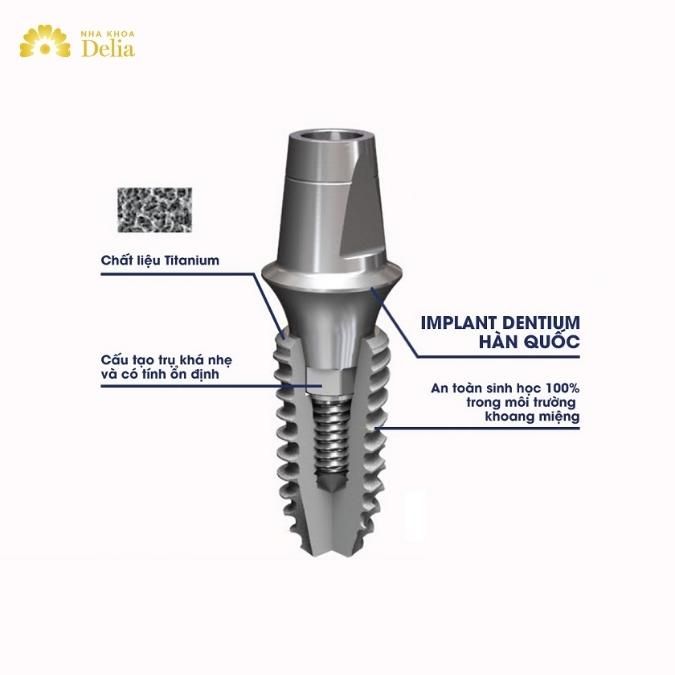 Đặc điểm cấu tạo của Trụ Implant Hàn Quốc
