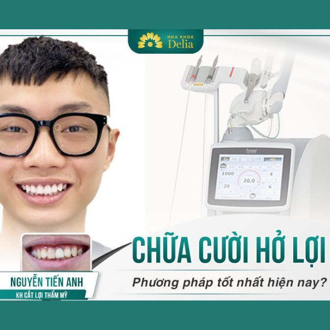 Cắt lợi không gây ra cảm giác đau nhức và khó chịu