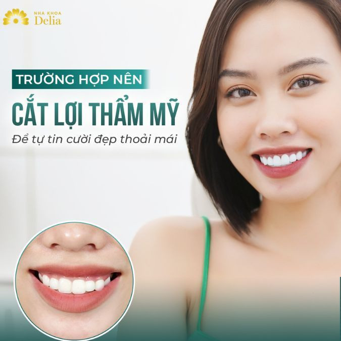 Sau 1 tuần, vết thương tại vị trí cắt lợi sẽ lành lại, bạn có thể ăn uống như bình thường