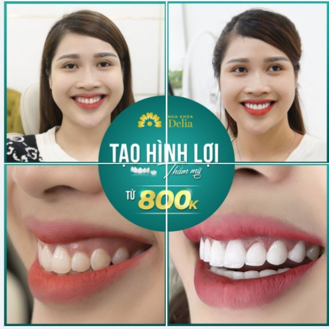 Nếu được thực hiện phẫu thuật cắt lợi tại những Nha khoa uy tín, bác sĩ giàu kinh nghiệm, tay nghề cao thì lợi sẽ không bị mọc lại