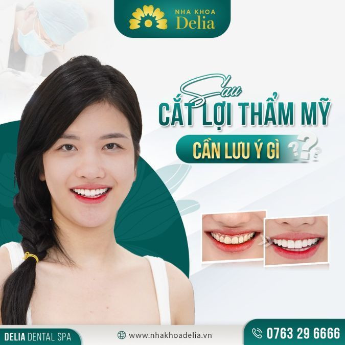 Ngay sau khi cắt lợi, bạn nên uống thuốc kháng sinh, chống viêm theo đơn thuốc của bác sĩ