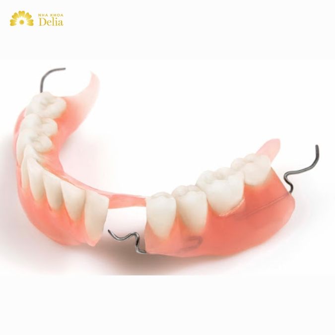 Hàm giả tháo lắp trên khung kim loại