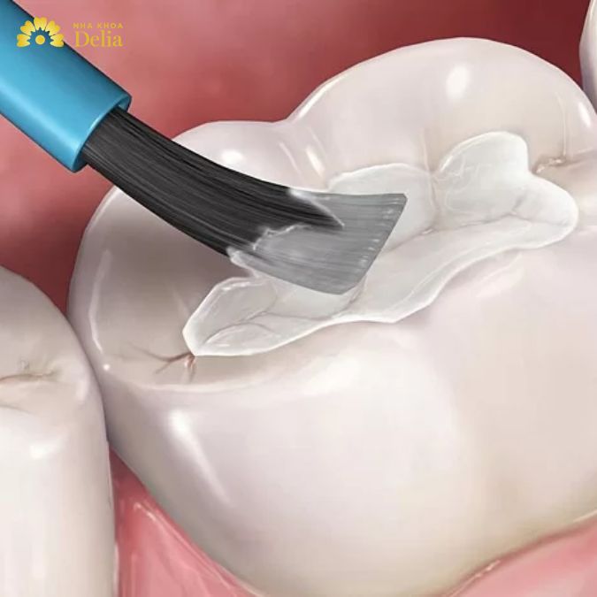 Một số phương pháp khắc phục khi răng bị sâu
