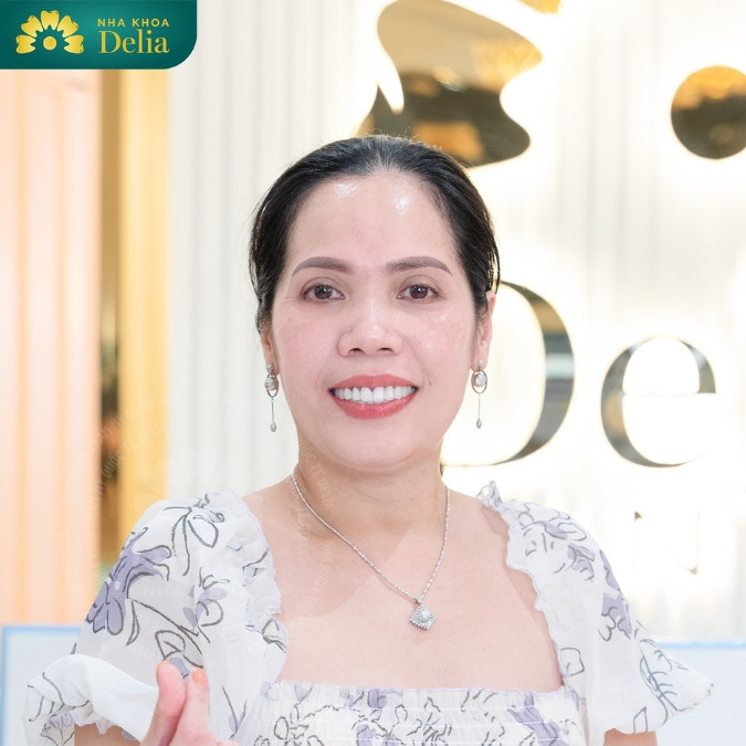 Trồng răng Implant All on 6 giá bao nhiêu?