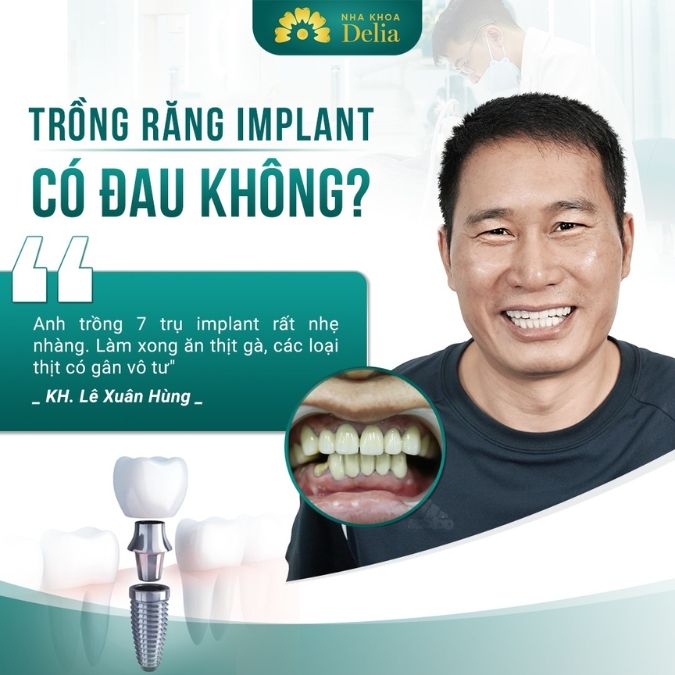7 lý do bạn cần phải biết trước khi quyết định trồng răng Implant