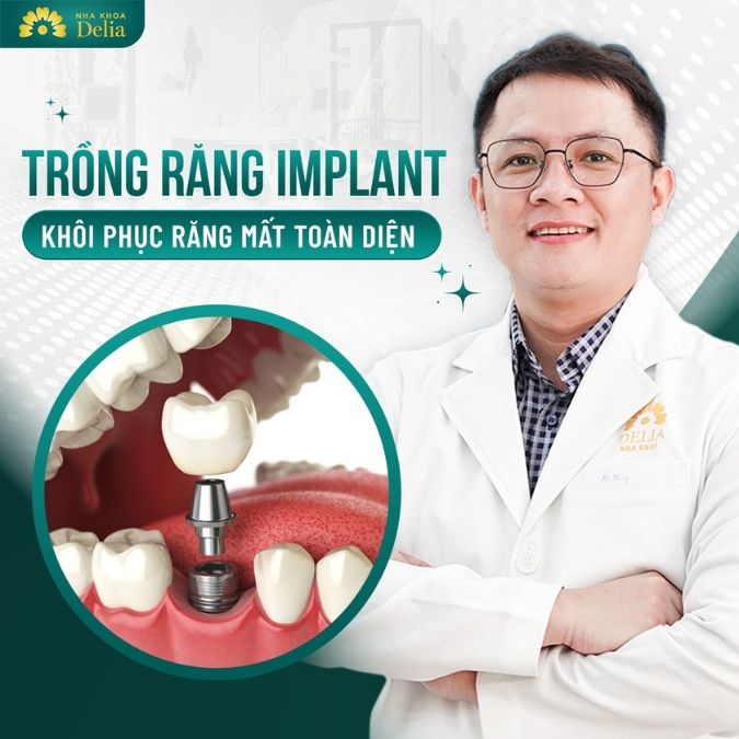 Trồng răng Implant là gì?