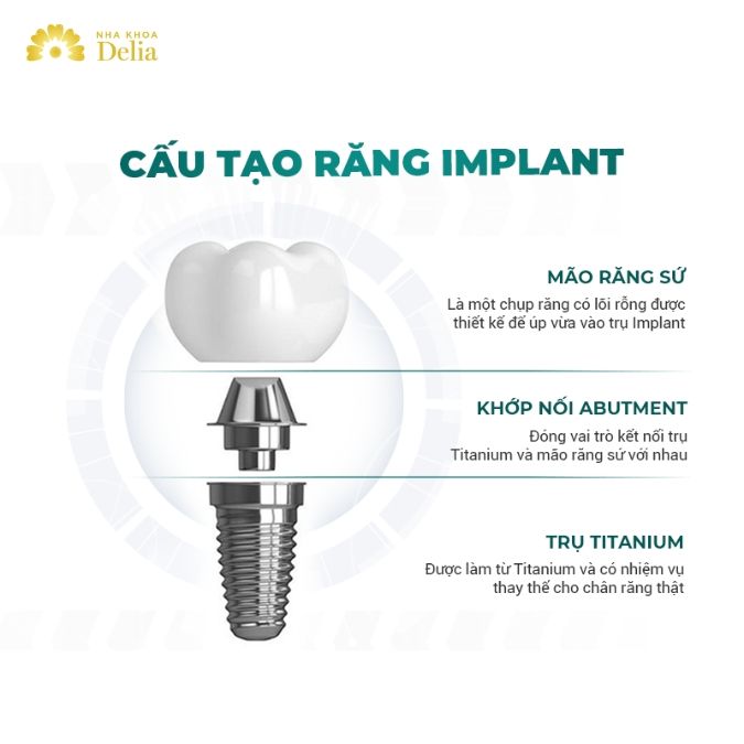 Tìm hiểu cấu tạo của một chiếc răng Implant