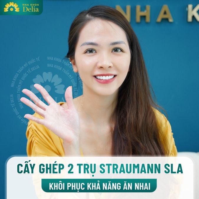 Dù giá cả có hơi cao, nhưng chất lượng và độ bền của trụ implant đích thực xứng đáng - Chị Mai Anh