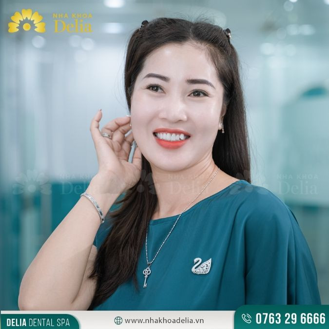 Đó là một khoản đầu tư xứng đáng cho nụ cười của mình - Chị Dung