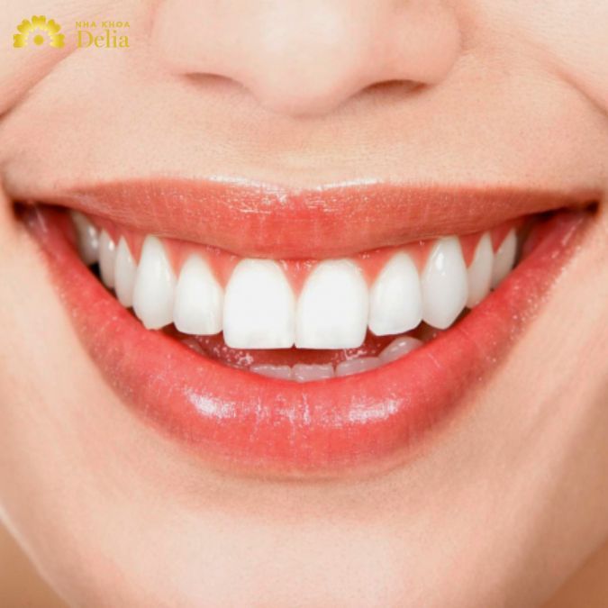 Top 10 Cách làm trắng răng tại nhà đơn giản, an toàn, hiệu quả nhất