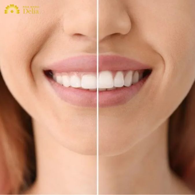 Chữ trị không cẩn thận có thể gây ra tình trạng nhiễm trùng
