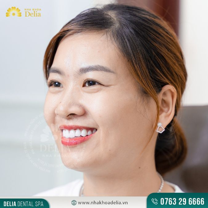 5 Tiêu chí đánh giá địa chỉ bọc răng sứ tốt