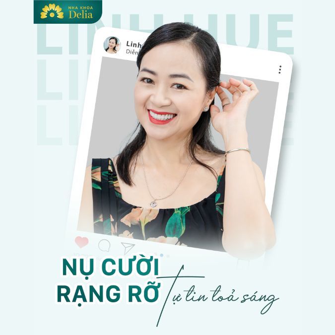 Nha khoa Delia – Địa chỉ bọc răng sứ tốt nhất tại Hà Nội và TP.HCM