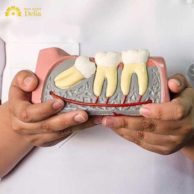 Nhổ răng số 8 ảnh hưởng đến răng số 7