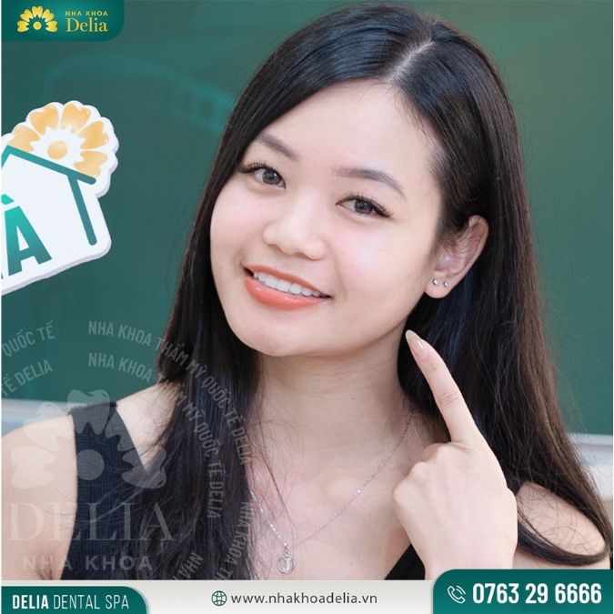 Trung bình giá răng sứ Lisi khoảng 10 triệu/ răng thuộc phân khúc tầm trung 