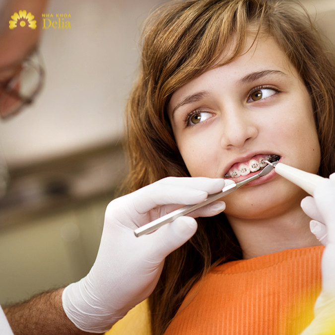 Chỉ nên niềng răng khi răng miệng ổn định