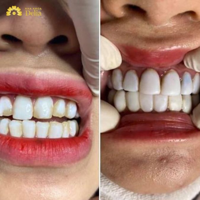 Phủ sứ Nano – Công nghệ “đội lốt” kéo theo biến chứng khôn lường