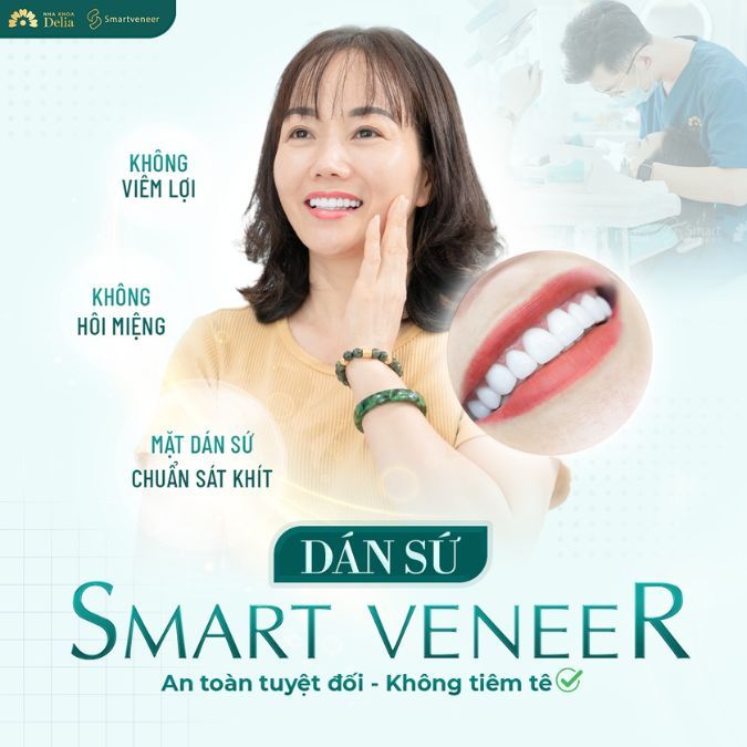 Sau khoảng 2 -3 ngày, bác sĩ sẽ gắn thử mặt dán sứ Veneer lên răng