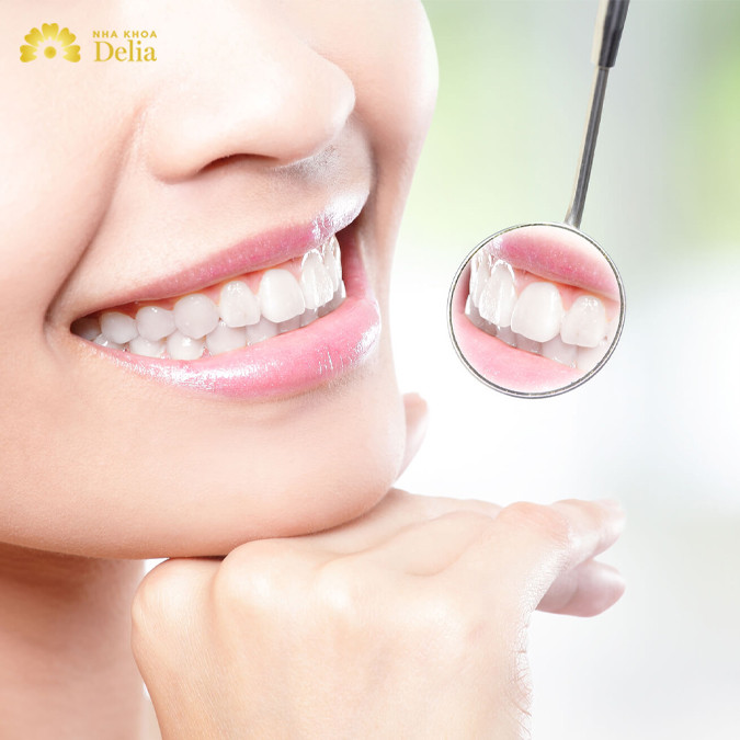Không hút thuốc, không ăn đồ cay nóng, uống nhiều nước trong quá trình điều trị viêm nướu