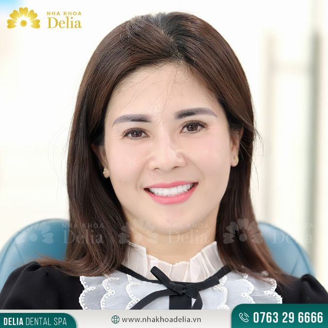 Tầm quan trọng của việc lựa chọn dáng răng sứ