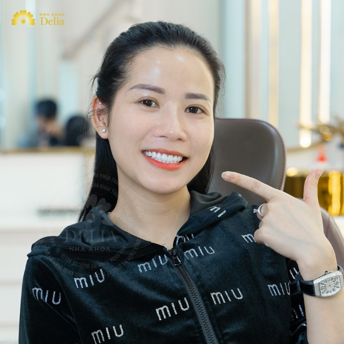 Các dáng răng sứ đẹp và được nhiều người lựa chọn hiện nay