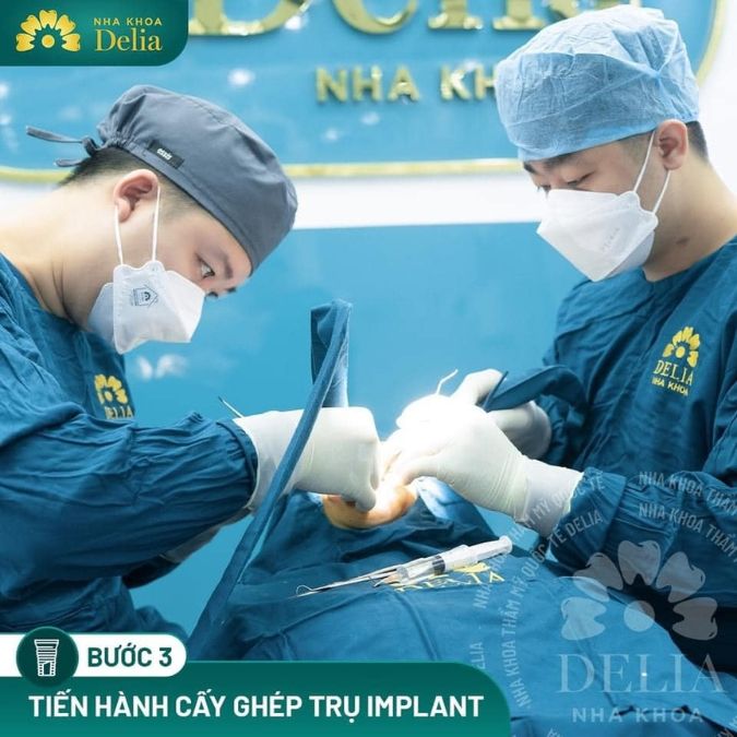Quy trình trồng răng Implant chuẩn Hoa Kỳ tại Nha khoa Delia