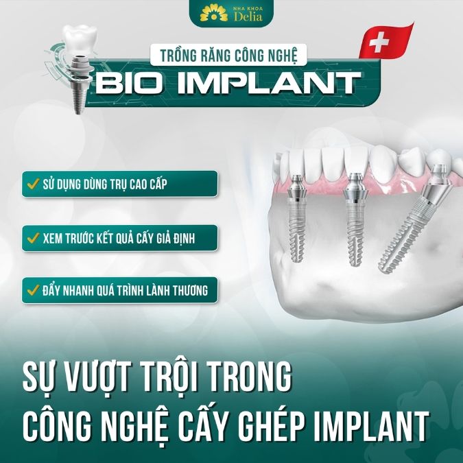 Delia - Viện trồng răng Implant chuẩn Hoa Kỳ