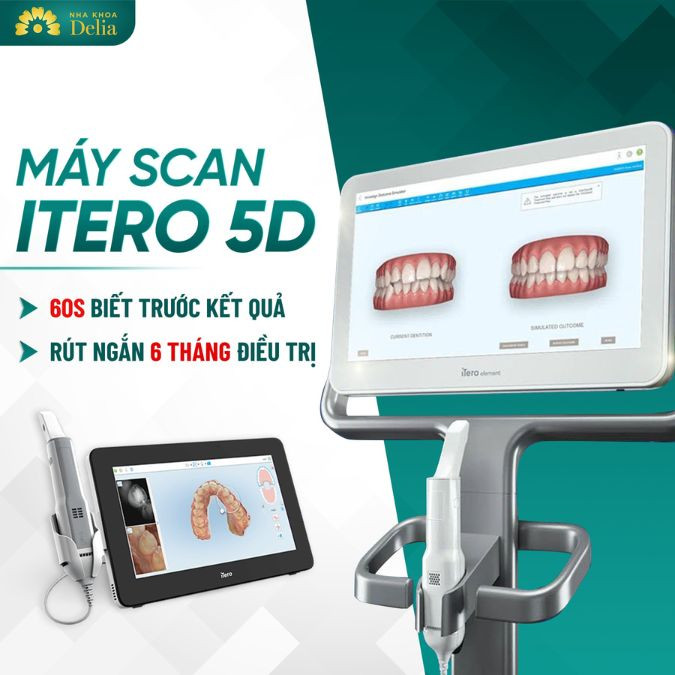 Đặc biệt nha khoa đã ứng dụng trí tuệ nhân tạo trong niềng răng “Trợ lý ảo nha khoa” iTero 5D