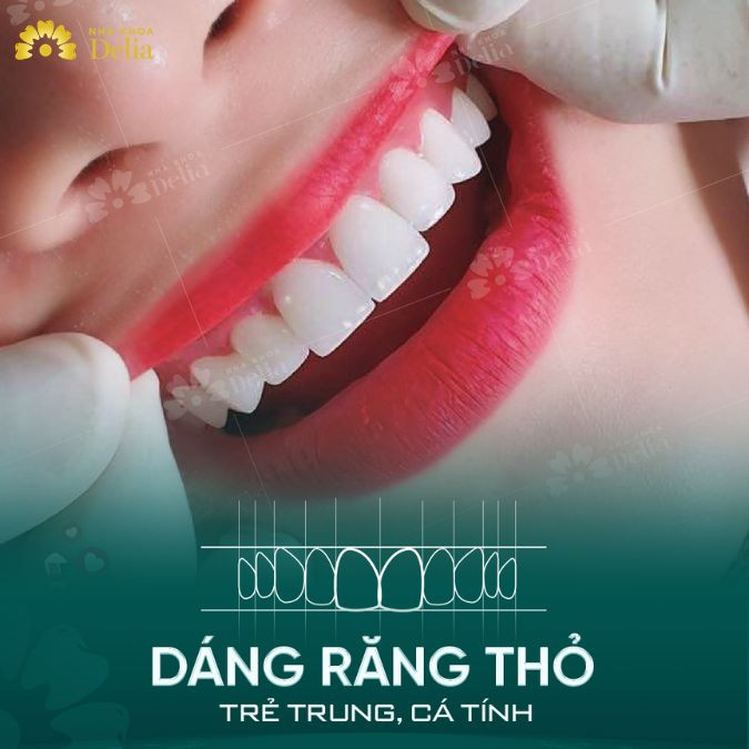 Dáng răng sứ thỏ