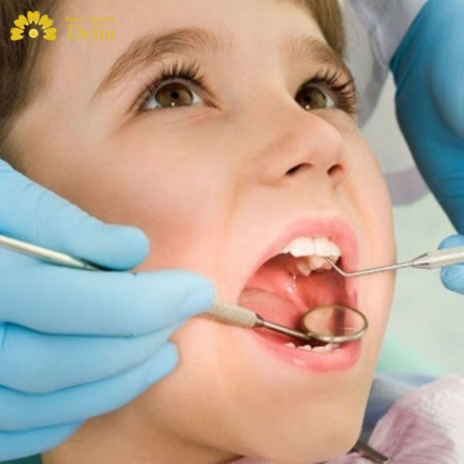 Răng vĩnh viễn của trẻ đang trong quá trình phát triển và hoàn thiện không nên bọc sứ