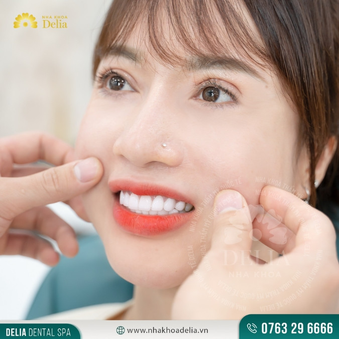Trường hợp nào các bác sĩ khuyến cáo trẻ 14 tuổi không được bọc sứ?