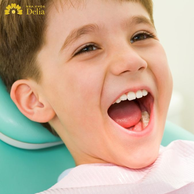 Trẻ em 14 tuổi có bọc răng sứ được không? Các bác sĩ không khuyến khích điều này