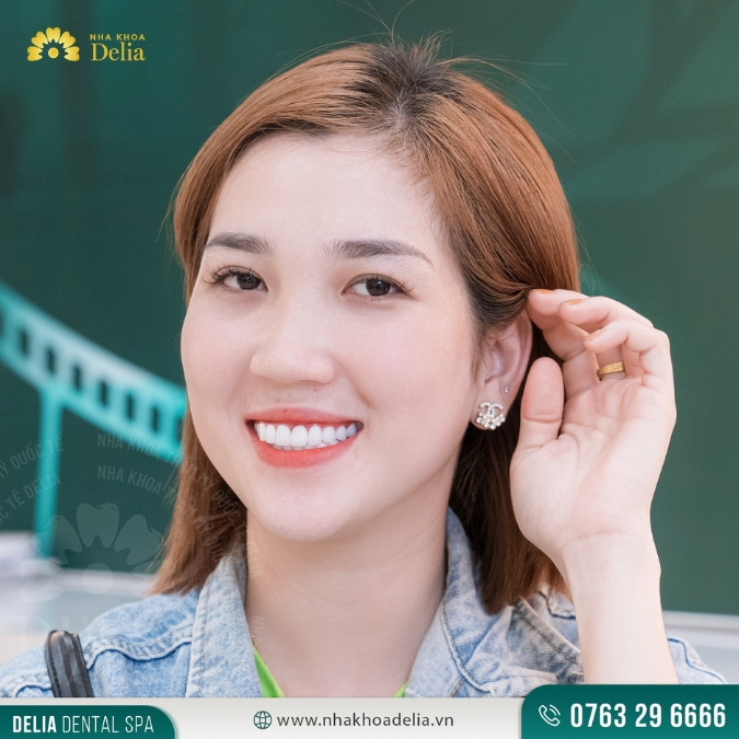 15 tuổi bọc răng sứ được không?