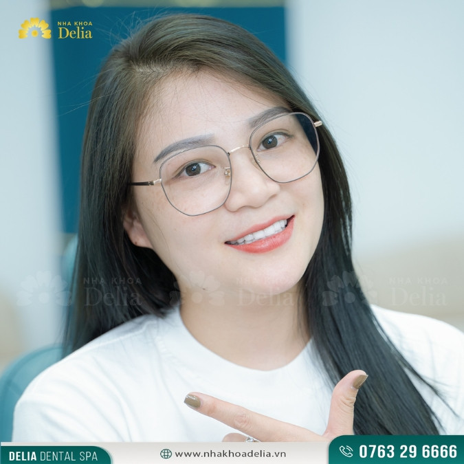 Trường hợp nào 15 tuổi có thể bọc răng sứ thẩm mỹ?