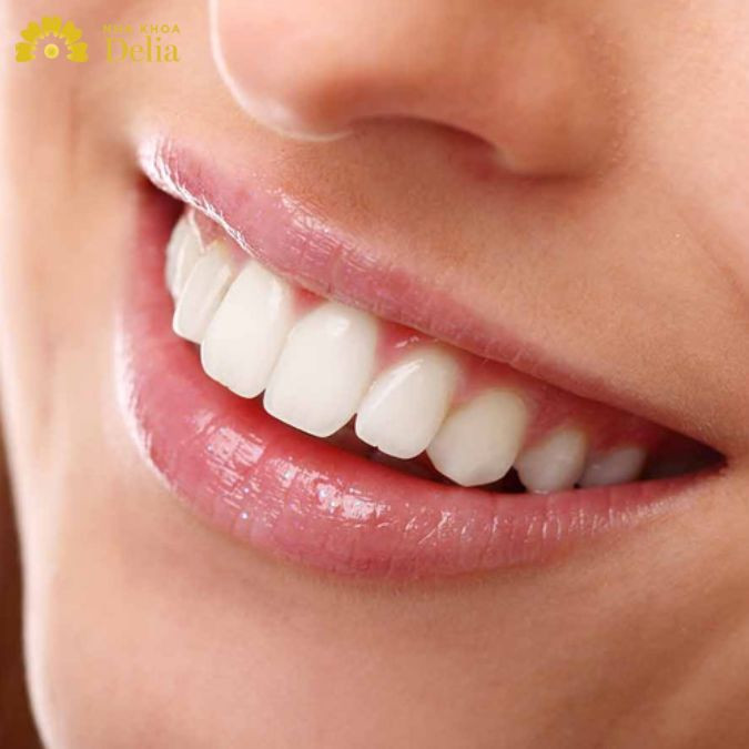 Dưới độ tuổi 18 tốt nhất không nên bọc răng sứ