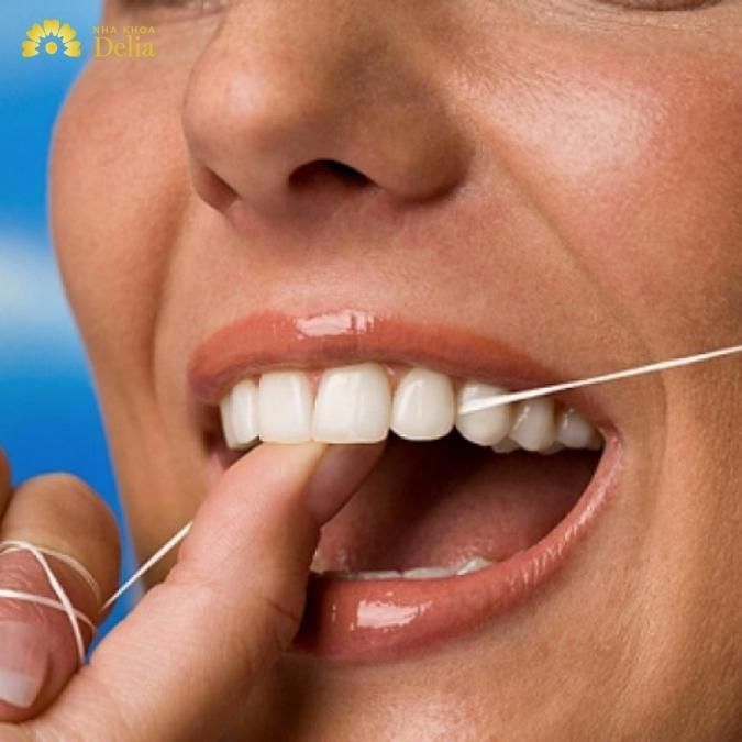 Chăm sóc đúng cách sau làm răng sứ 2 răng cửa