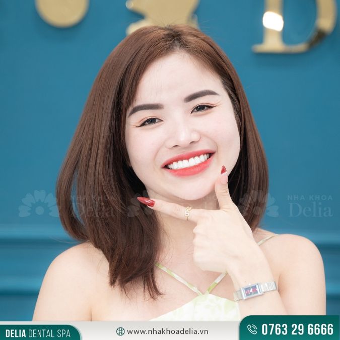 Bọc sứ răng cửa bao nhiêu tiền? Có nhất định phải bọc sứ cho răng cửa?