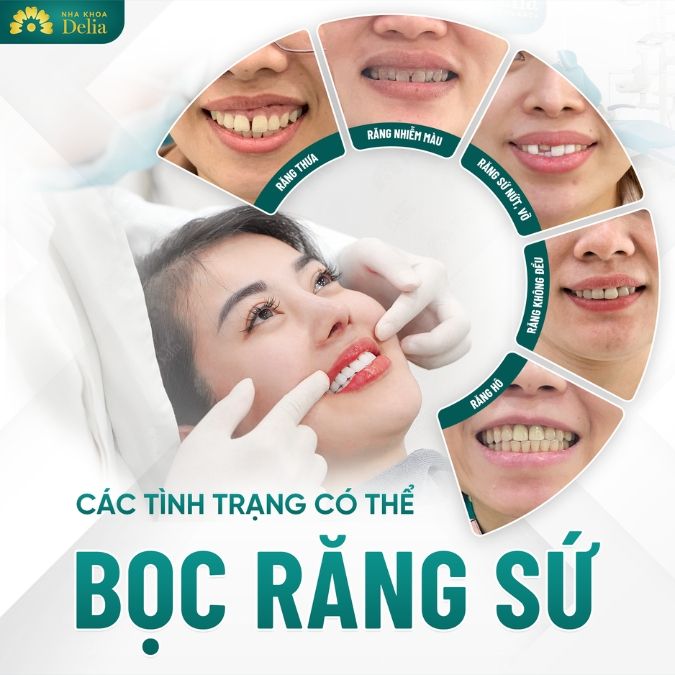 Bọc sứ răng cửa là gì? Bọc sứ răng cửa phù hợp cho đối tượng nào?
