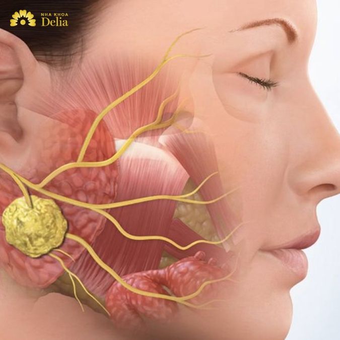 Một số hậu quả khôn lường khi răng số 8 mọc sai cách