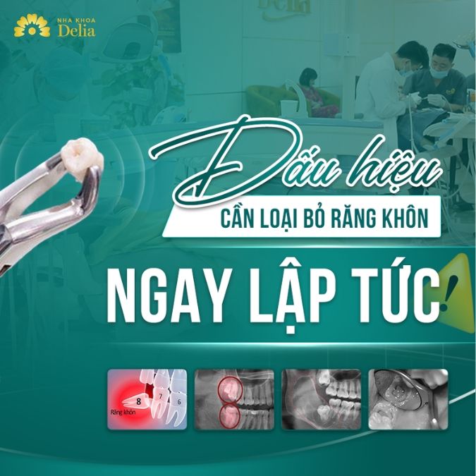 Mất răng số 8 có ảnh hưởng gì đến răng toàn hàm không?