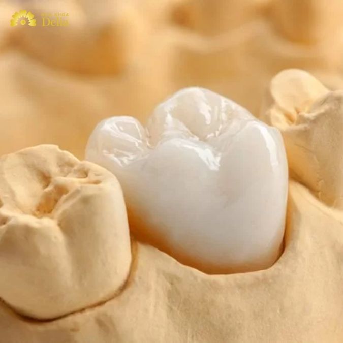 Bọc sứ răng số 8 có phải giải pháp hiệu quả nhất cho mọi tình trạng không?