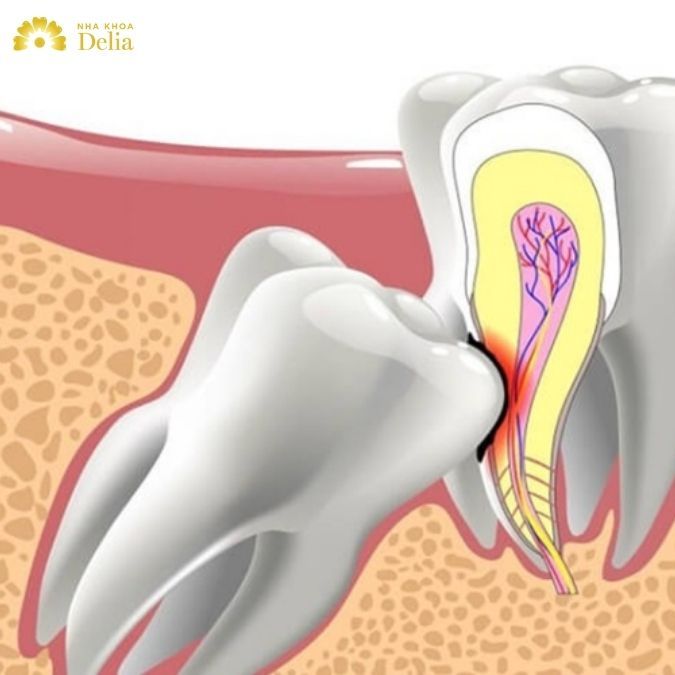 Số lượng chân răng sẽ tùy thuộc vào vị trí của răng